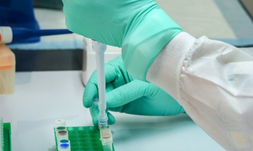 軟骨無形成症の経口薬候補「インフィグラチニブ」、厚生労働省が希少疾病用医薬品に指定——協和キリン